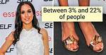 10+ Rare Body Features That You Might Have