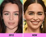 11 Celeb Close-Ups That Show How Their Faces Have Changed over the Decades