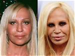 11 Celebrities Who Shunned Cosmetic Surgery and Embraced Their Natural Look