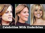 12 Celebrities with Great Underbites