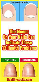 13 Health Problems the Moons on Your Nails Warn You About
