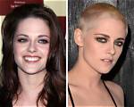 17 Celebrities Who Decided to Change Their Teeth and Started Shining Even Brighter
