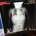 17 Weird X-Ray Photos for Those Who Think They’ve Seen It All (We Still Can’t Get over Spongebob)