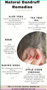 3 Natural Remedies for Nixing Summer Dandruff