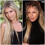 Adixia Avant Chirurgie: "Transformation D'adixia Avant Et Après Chirurgie Esthétique: Découvrez Son Evolution Incroyable En 2023!"