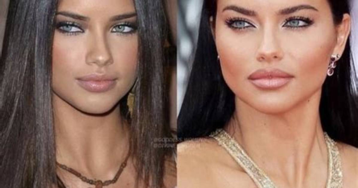 Adriana Lima Chirurgie: "Adriana Lima Face Aux Rumeurs De Chirurgie Esthétique: Cequ'elle Dit"