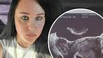 Amanda Bynes Baby, Child, Children, Did Amanda Bynes Have a Baby?
