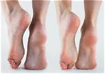 Arch Disorders