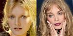 Arielle Dombasle Chirurgie