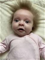 Baby Born with ‘Silver’ Hair and His Parents Are Baffled! – India Tv
