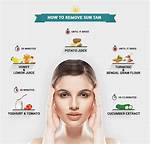 Best Ways to Treat Sun Tan