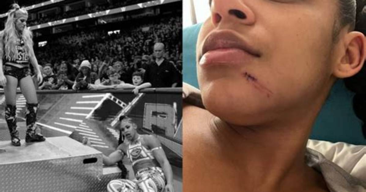 Bianca Belair Shows Stitches After Alexa Bliss’ Attack on Wwe Raw