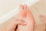 Blisters | Foot and Ankle Specialists