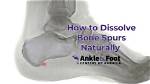 Bone Spur Pain, Relief, Treatment