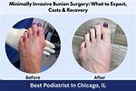 Bunion & Foot Surgery - Podiatrist in San Diego