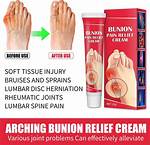 Bunion Treatment and Pain Relief