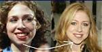 Chelsea Clinton Plastic Surgery | and the Evolution of Glamour