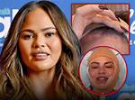Chrissy Teigen Shocks Fans with New Plastic Surgery