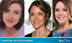 Christa Miller Plastic Surgery: Christa's Surgery or Skincare Should Be Credited?