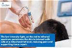 Cold Laser Therapy - What Is It Exactly?