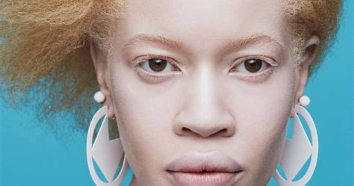 Diandra Forrest
