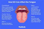 Does Hiv Smell Fishy? Understanding the Connection Between Hiv and Vaginal Odor