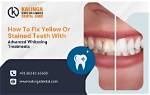 Easy Fix for Yellow Teeth with the Snow® Teeth Whitening Kit Pearly Whites Keep 'Em Shining Bright. .. W/ a Teeth Whitening Kit 10 10/28/2022 10:00 Am Pt