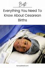 Everything You Need to Know About Cesarean Sections