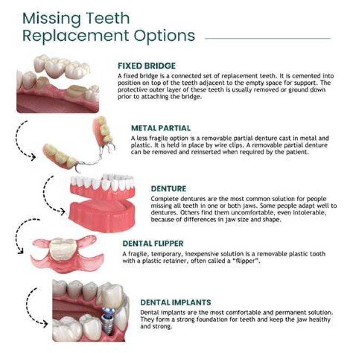 Exploring Temporary Replacement Options for Hungry Individuals & More!