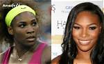 Fascinating Story About Serena Williams Facial Surgery