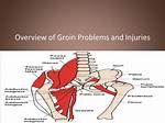 Groin Pain After Back Surgery
