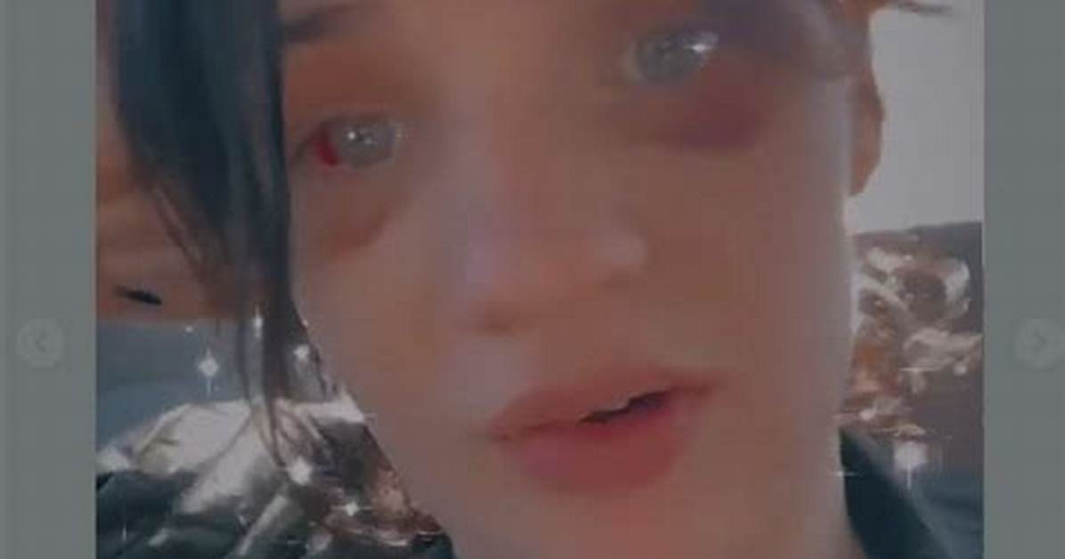 Haley Grace Phillips: Wiki, Age Who Is She, Is Haley Grace Phillips Dead?