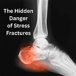 Heel Pain & Stress Fractures