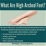 High Arches