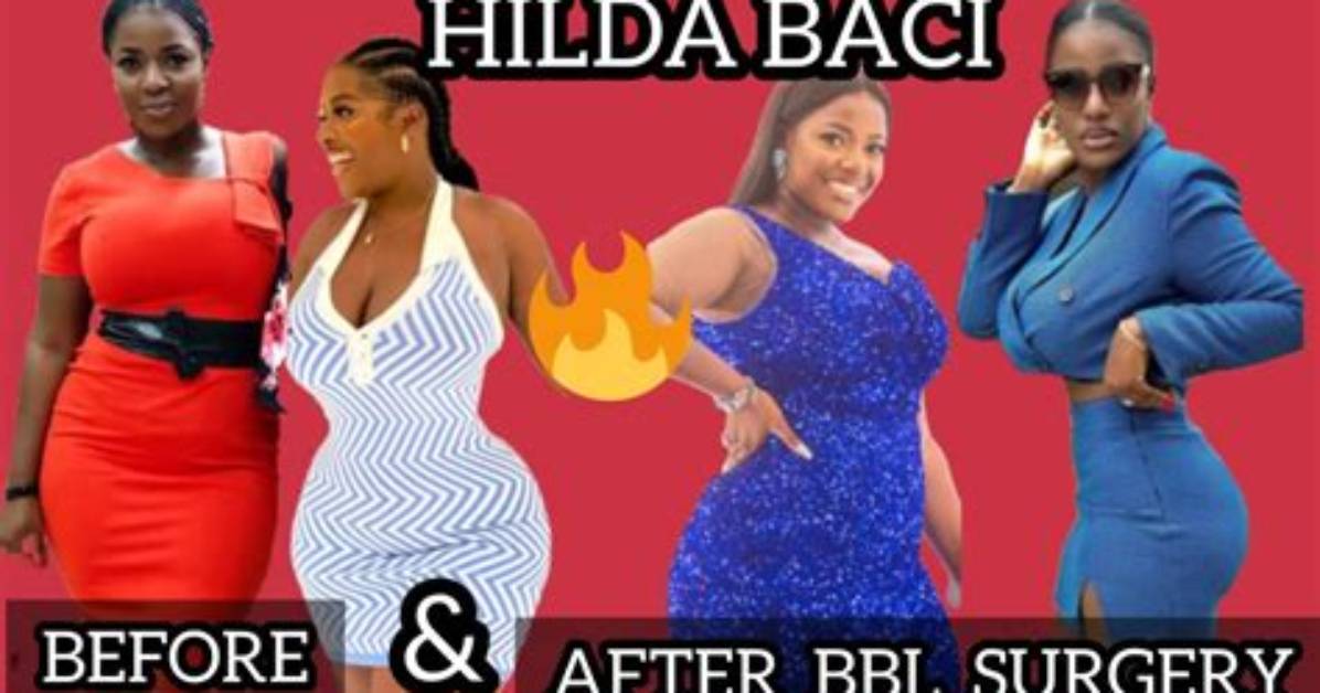 Hilda Baci’s Bbl Rumors: Has the Nigerian Chef Had a Plastic Surgery? See Pictures of Her Curvy Shape