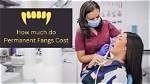 How Much Do Permanent Fangs Cost? Factors Affecting Price Revealed