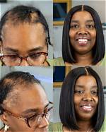 How to Accept Insurance for Wigs - a Comprehensive Guide
