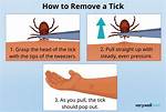 How to Remove a Tick?