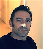 Hugh Jackman Diagnosed with Skin Cancer for Third Time in One Year