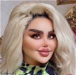I’ve Had 43 Cosmetic Procedures to Look Like a Barbie, but Critics Say I Look Like a “Zombie”