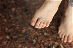 Ingrown Toenail Specialists - Sacramento Foot and Ankle Center