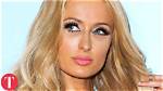 Is There Something Wrong with Paris Hilton’s Feet?