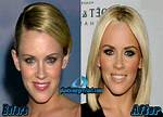 Jenny Mccarthy Plastic Surgery: the Truth About Her Cosmetic Enhancements