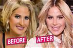 Kim Zolciak-Biermann Before Surgery Pics, Nose Job Age and Partner