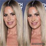 Kim Zolciak Nose Job: Everything You Need to Know