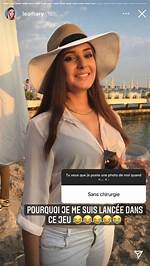 “Lea Mary Avant Chirurgie: Son Apparence Avant Les Interventions Esthétiques”