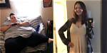 Life Before and After Surgery
