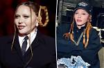 Madonna Shows off ‘Cute’ Face After ‘Swelling from Surgery’ Went Down