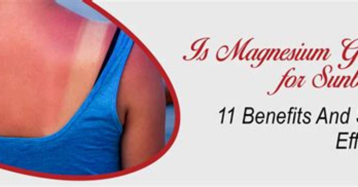 Magnesium for Sunburn - Statcare