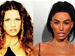 Maria Arreghini Chirurgia Estetica: Plastic Surgery Before and After Photos